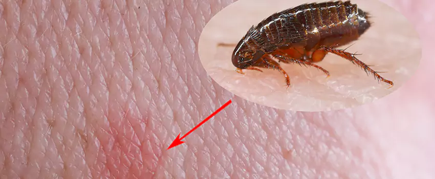 Flea Control for Humans Richardson, TX